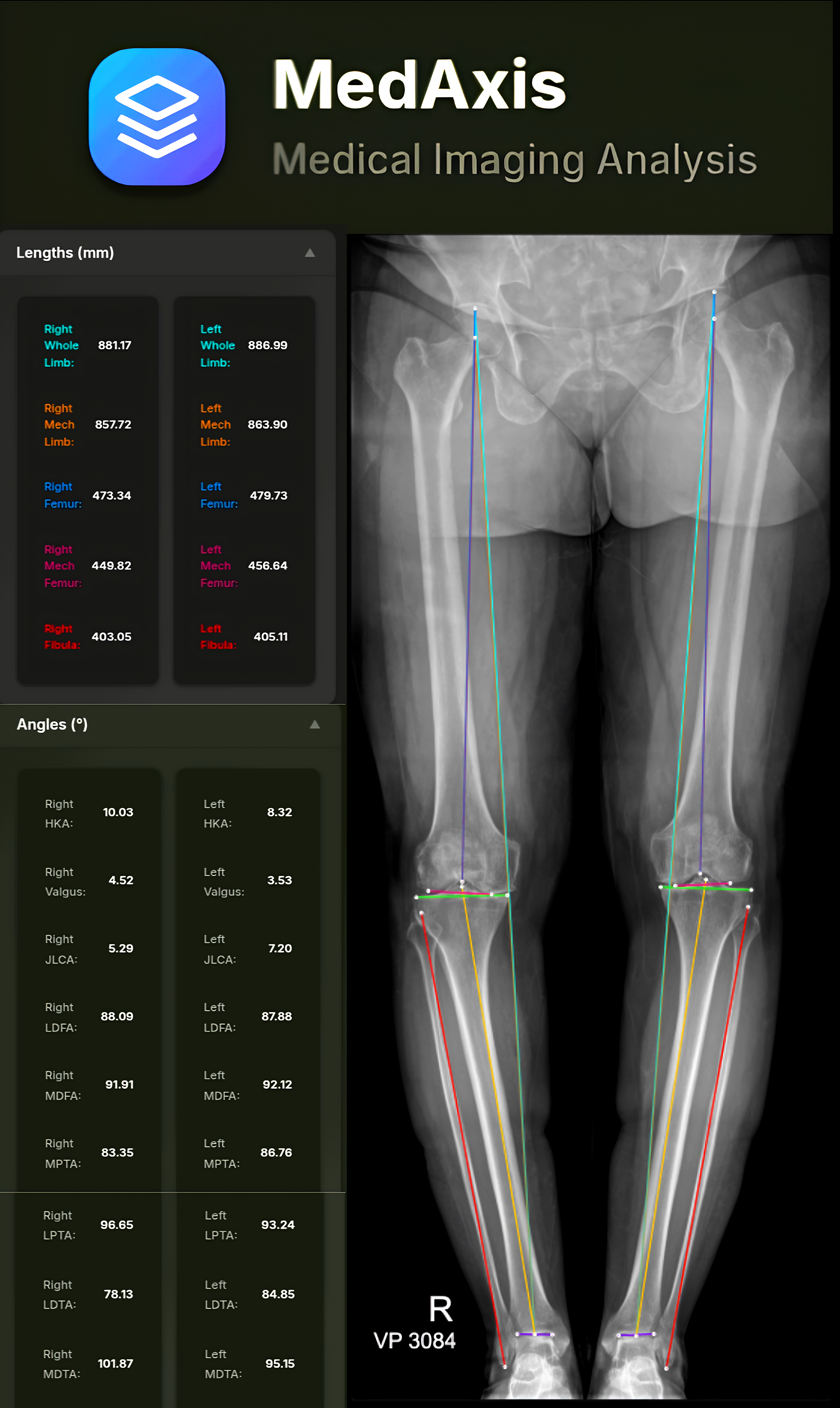 MedAxis Analysis Interface